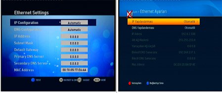 Digiturk Ethernet Ayarları